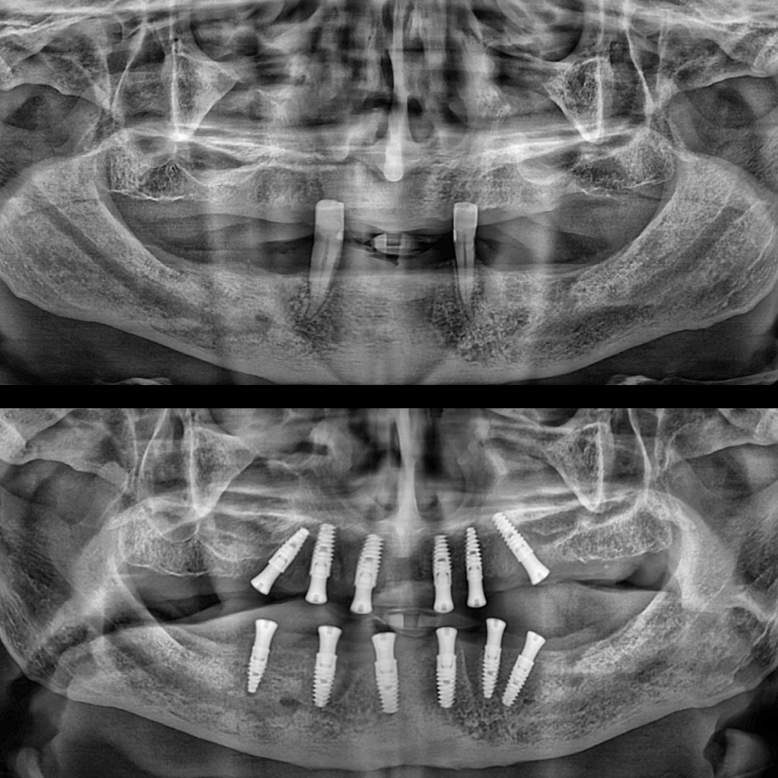 Oral and Maxillofacial Surgery (Extraction and Implant Applications)