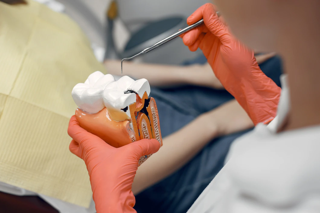Endodontics (Root Canal Treatment)