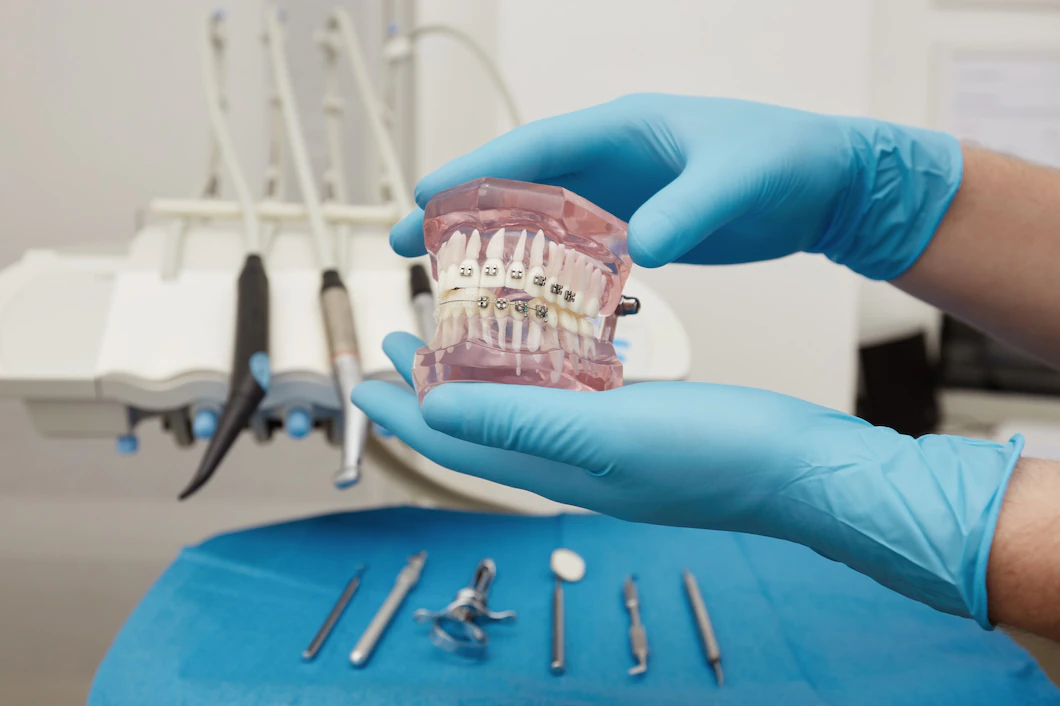 Orthodontics (Braces Applications)
