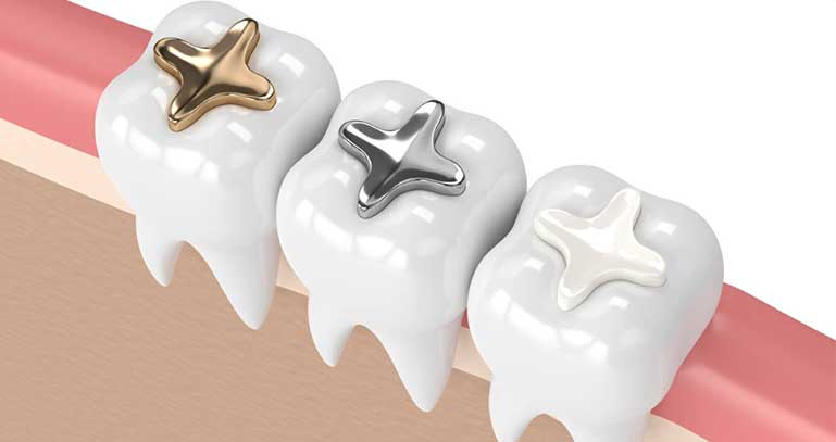 Conservative Dental Treatment (Filling Applications)