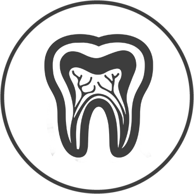 Endodontics (Root Canal Treatment)