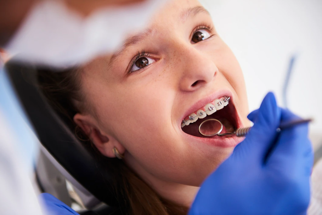 Orthodontics (Braces Applications)